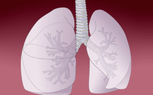 Developing lung cancer prevention strategies